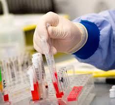 Testul de sange care poate indica riscul de cancer