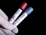 Un test, efectuat la domiciliu, poate depista HIV in 15 minute