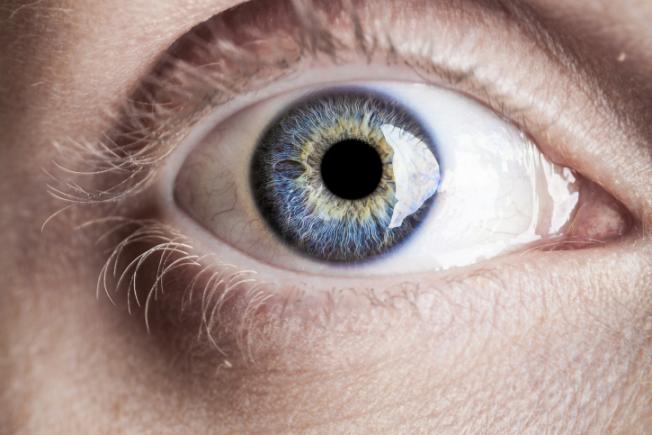 Melanomul afectează pielea, dar şi ochiul 