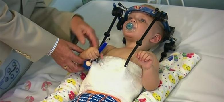 Un adevărat miracol: Un chirurg a reuşit să prindă capul de restul corpului în cazul unui bebeluş, victimă a unui accident rutier