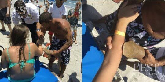 O tânără mușcată de un rechin, transportată cu acesta la spital