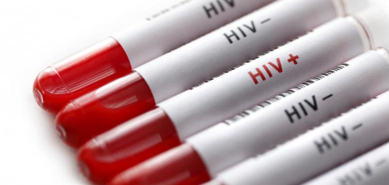 OMS: HIV începe să devină rezistent la medicamente!