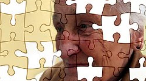 Vitamina D poate preveni  maladia Alzheimer 