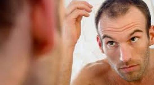 Căderea părului: 47% dintre bărbaţii din România au această problemă. Majoritatea sunt  stresaţi, bucureşteni, căsătoriţi
