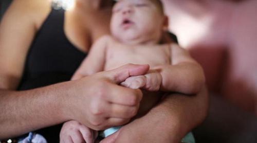 Virusul Zika, bănuit şi de deformarea articulaţiilor la nou-născuţi