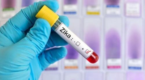 Virusul Zika, o soluție contra glioblastomului, cel mai agresiv cancer al creierului 