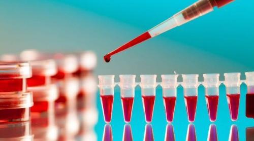 Un nou test de sânge poate prezice cât de gravă va fi infecția cu COVID-19