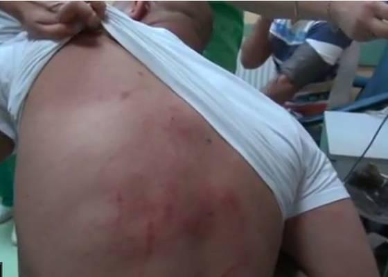 Incident. Polițiștii i-au spart capul fratelui unui deputat (VIDEO) Incident. Polițiștii i-au spart capul fratelui unui deputat (VIDEO)