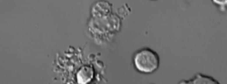 Cercetătorii australieni au filmat moartea unei celule albe! Momentul „decesului” dă semnalul că există un risc de infecţie în organism (VIDEO) Cercetătorii australieni au filmat moartea unei celule albe! Momentul „decesului” dă semnalul că există un risc de infecţie în organism (VIDEO)