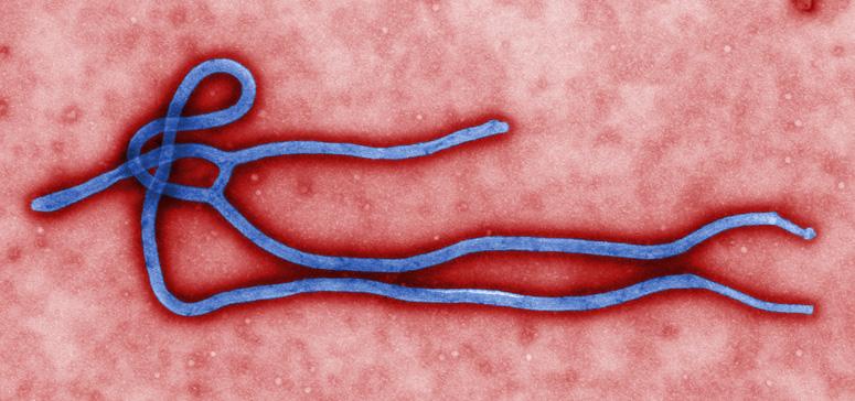 VIDEO: Un test rapid, pe suport de hârtie, pentru depistarea Ebola