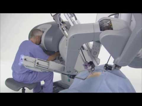 operatie de prostata cu robot