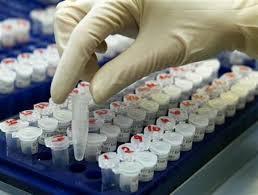 Testul de urină care depistează virusul hepatitei C