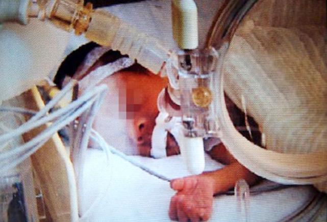 Un băieţel, declarat mort, a început să plângă înainte de a fi incinerat