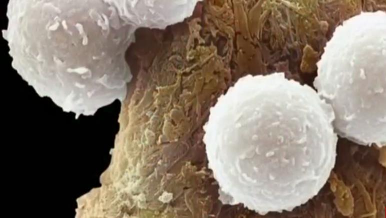 Tratarea cancerului. Rezultate pozitive fără precedent, anunțate de o echipă de cercetători americani (VIDEO)