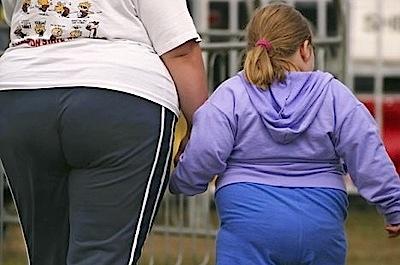 Copiii obezi amenințați de ciroză 