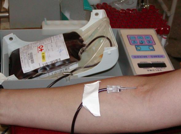 transfuzie de sânge anti-îmbătrânire)