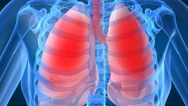 Cancer pulmonar: Tratament de primă linie, în locul chimioterapiei