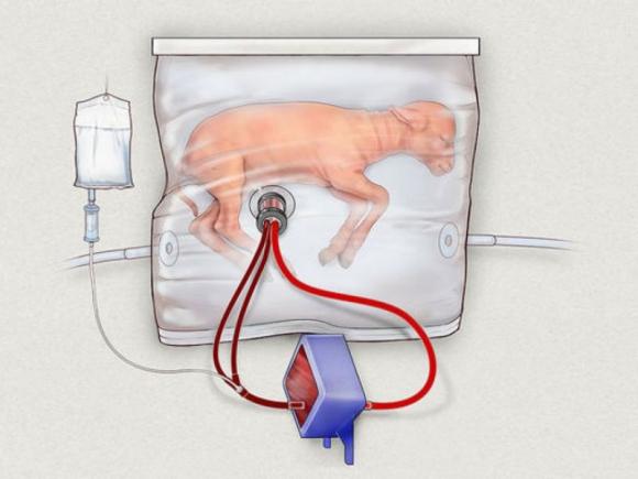 Uterul artificial pentru bebeluşii prematuri (VIDEO)