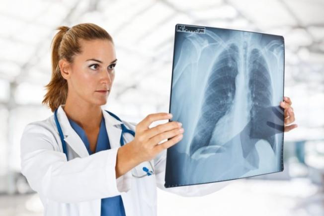 cum să faci cancerul pulmonar rapid
