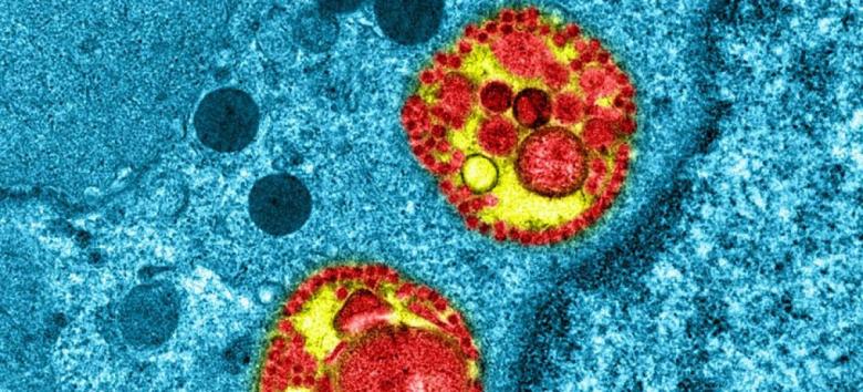 Coronavirusul circula în Franța încă din luna ianuarie, cu intensitate mică, potrivit cercetătorilor de la Institutul Pasteur