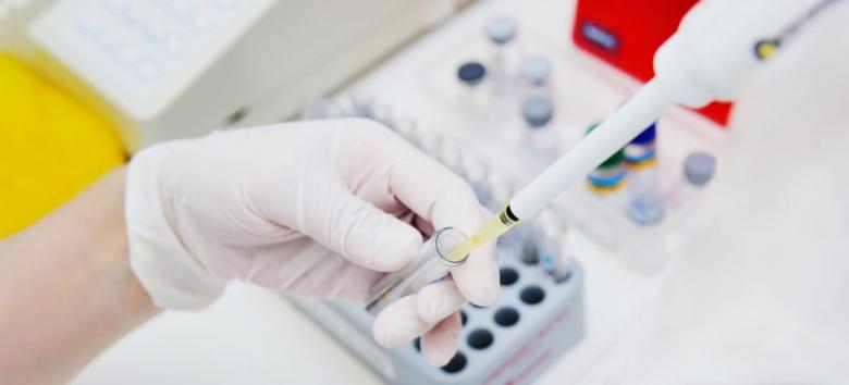 Statele Unite aprobă un nou test de coronavirus, care permite prelevarea mostrelor acasă