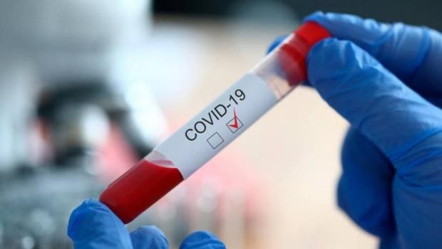 Ne apropiem de 30.000 de infectări cu noul coronavirus. Azi au fost raportate încă 397 de cazuri