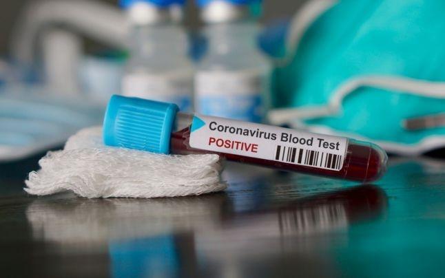 Oamenii cu vârste între 20 şi 40 de ani contribuie, uneori involuntar, la răspândirea coronavirusului, este de părere OMS