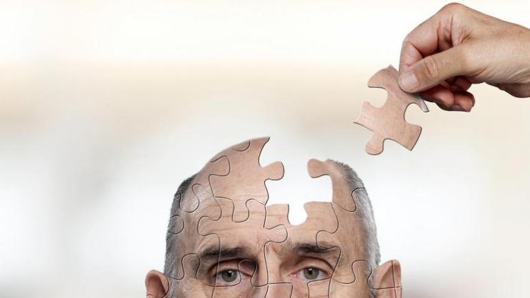  Supraponderalii riscă să se îmbolnăvească mai repede de Alzheimer