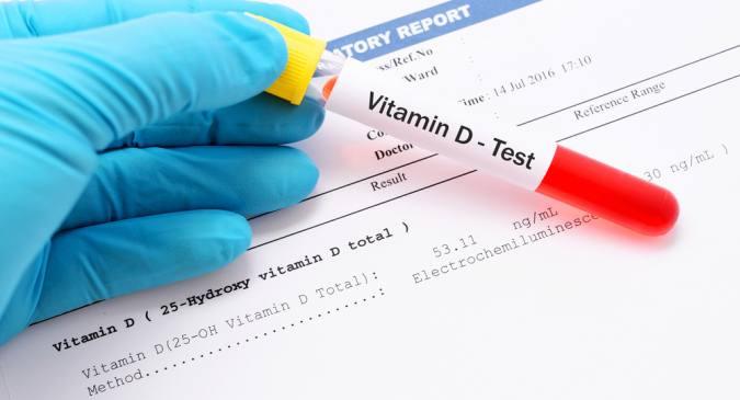 Peste 80 % dintre cei care suferă de COVID-19 au o lipsă de vitamina D
