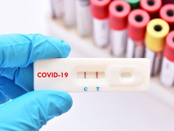 Eficiența testelor rapide: Doar 1 din 2 cazuri de COVID-19 confirmate prin RT-PCR este identificat și prin test rapid