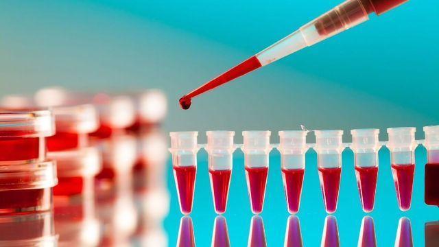 Un nou test de sânge poate prezice cât de gravă va fi infecția cu COVID-19