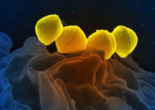 O boală bacteriană, ”mâncătoare de carne”, se răspândește în Japonia. Unii pacienți mor în doar 48 de ore de la infecție!