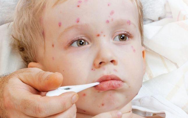 Tradiţii şi superstiţii. Sfaturi băbeşti. Cum vindeci de pojar copilul