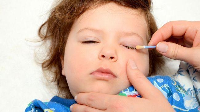 Tradiții și superstiții. Sfaturi băbești. Cum scapi de conjunctivită