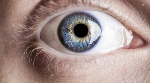 Melanomul afectează pielea, dar şi ochiul 