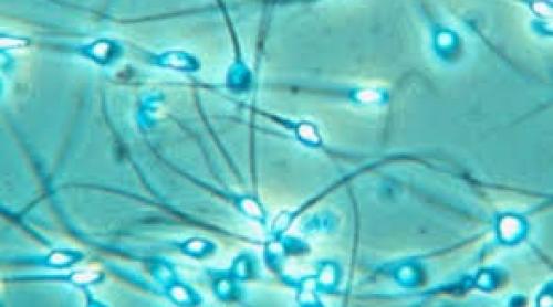 Performanţă medicală: spermatozoizi obţinuţi in vitro