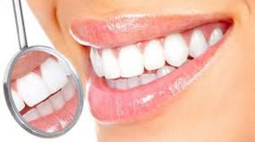 Dinţi din sticlă bioactivă contra cariilor dentare şi bacteriilor din cavitatea bucală