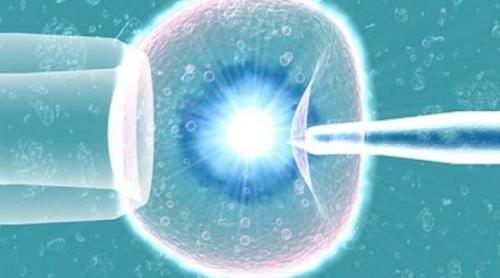  Fertilizare in vitro: Confuzie în privinţa spermatozoizilor folosiţi!