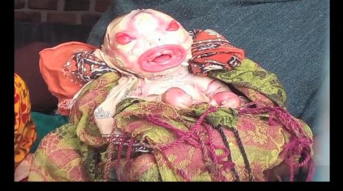 Spital luat cu asalt după naşterea unui copil-extraterestru (Video)