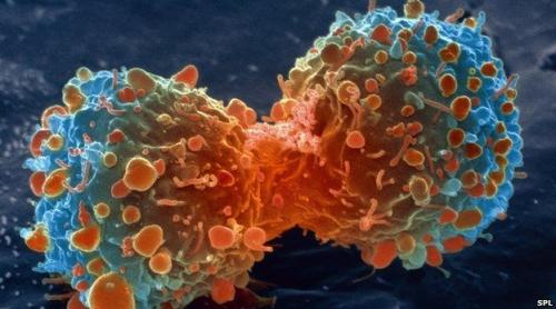 Tratament anti-cancer, care ţinteşte "călcâiul lui Ahile" al tumorii!