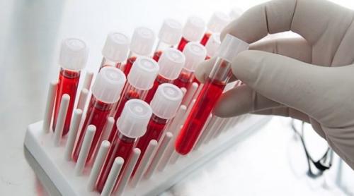Testul de sânge care surprinde cancerul pancreatic în primele stadii