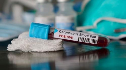 Al patrulea caz de infectare cu coronavirus în România. Este vorba despre un bărbat de 47 de ani