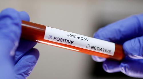 Coronavirus: „Pentru tratarea COVID-19, toată lumea va lua clorochină”