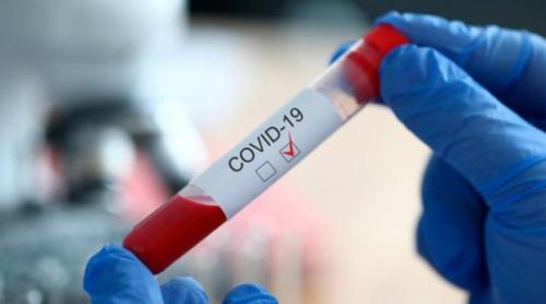 Pacienții COVID-19 asimptomatici vor fi izolați la domiciliu, după 10 zile de spitalizare