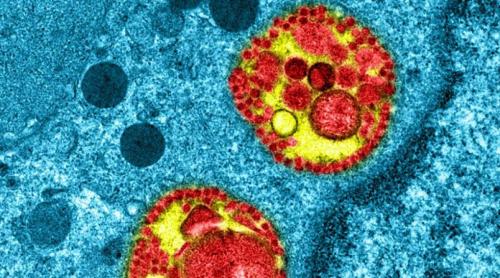 Un ucrainean s-a infectat cu coronavirus pentru a treia oară