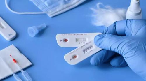 Testele rapide pentru depistarea infecției cu SARS-CoV-2 sunt disponibile în farmacii