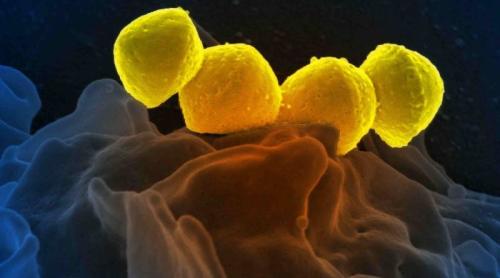 O boală bacteriană, ”mâncătoare de carne”, se răspândește în Japonia. Unii pacienți mor în doar 48 de ore de la infecție!