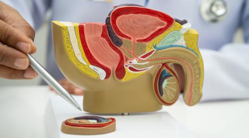 RMN Multiparametric de Prostată: tehnologia care elimină incertitudinea