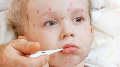 Tradiţii şi superstiţii. Sfaturi băbeşti. Cum vindeci de pojar copilul