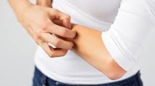 MANIA SCĂRPINATULUI, impuls necontrolat care se tratează la psiholog